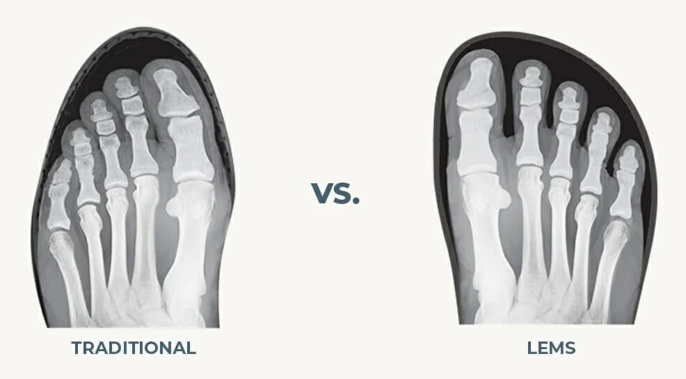 a big reason people love lems shoes: the wide toe box
